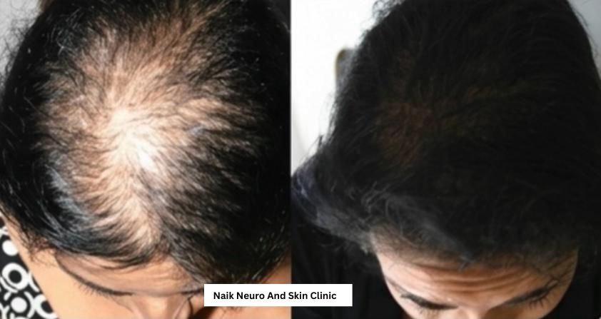 Hair Treatment Result