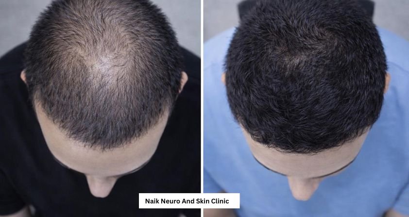 Hair Treatment Result