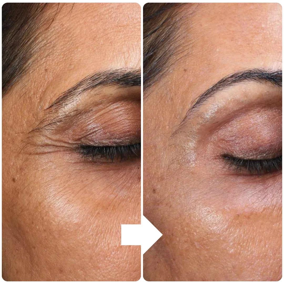 Advanced Skin Treatment