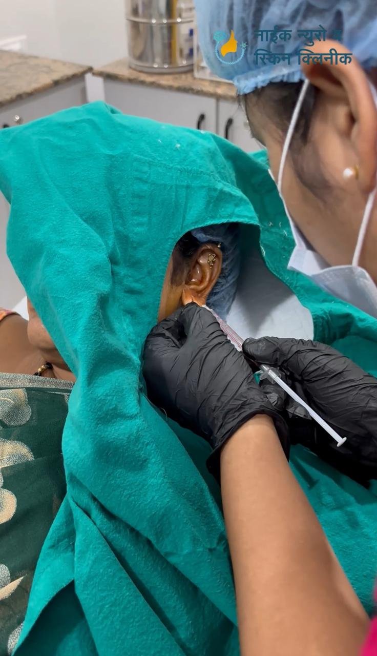 Dermatosurgery
